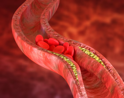 Vilão ou mocinho? Descubra como o colesterol afeta a sua saúde cardiovascular