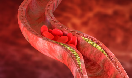 Vilão ou mocinho? Descubra como o colesterol afeta a sua saúde cardiovascular